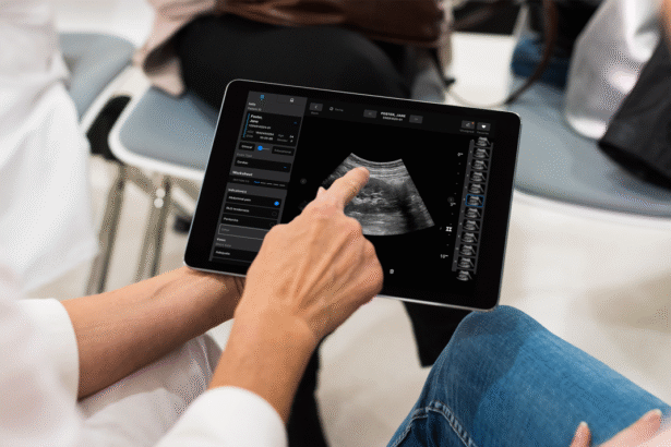 Samsung Looks to Revolutionize Medical Imaging with 0M Investment in Exo