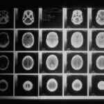 AI Triumphs: Microsoft’s AI tool surpasses doctors in diagnosing intricate medical conditions