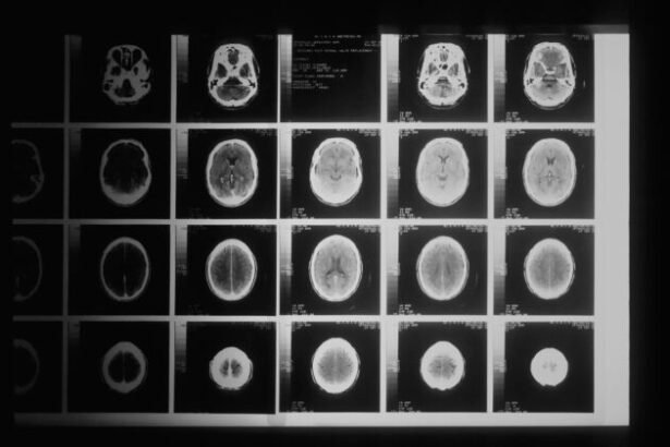 AI Triumphs: Microsoft’s AI tool surpasses doctors in diagnosing intricate medical conditions