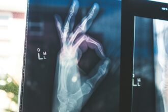 Revolutionizing Healthcare: How MedGemma AI Models are Changing the Game