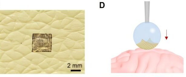 Revolutionizing Bioelectronic Interfaces: Unlocking the Potential of Drop-Printing Technology