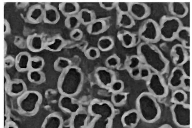 Revolutionizing Energy Storage: The Sustainable Supercapacitor Solution